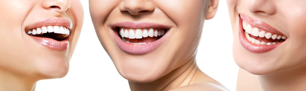 Consejos para que las carillas dentales duren mucho tiempo