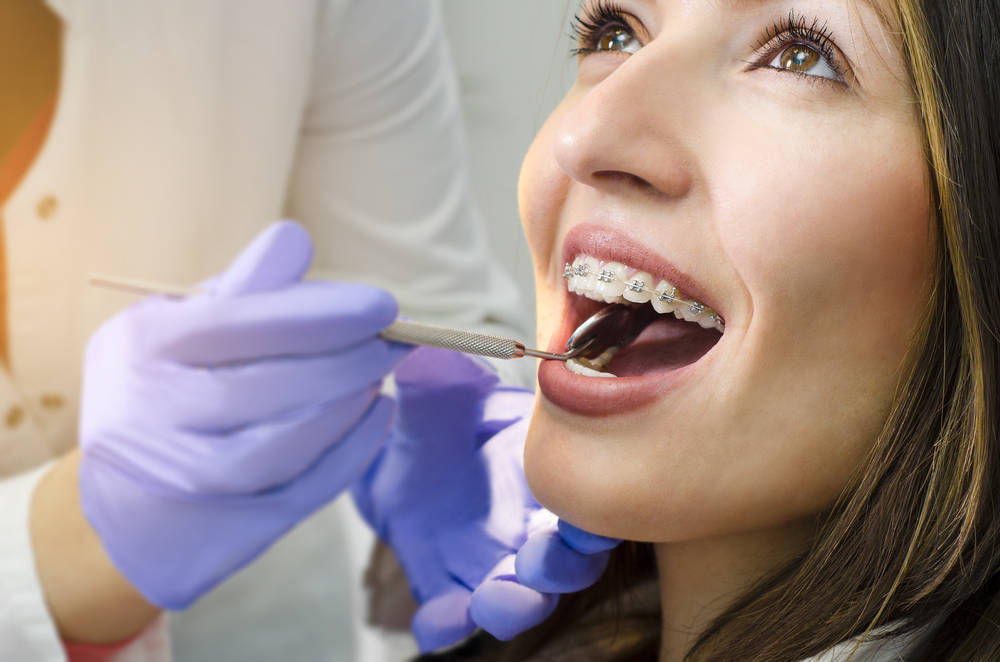 Información sobre la ortodoncia